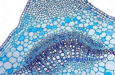 stem